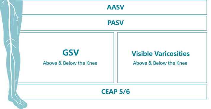 Blue leg with veins left of stacking text, AASV, PASV, GSV, Visible Varicosities, CEAP 5/6