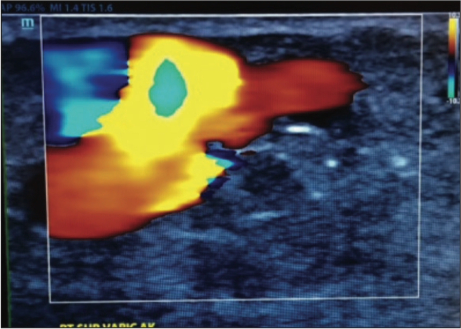 Abnormal scan results 