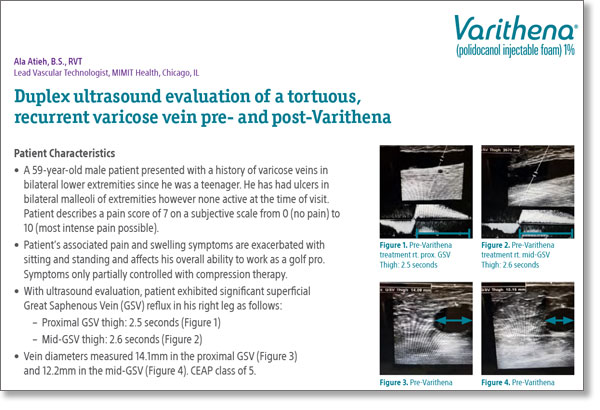 Case study first page with title and images of four ultrasounds