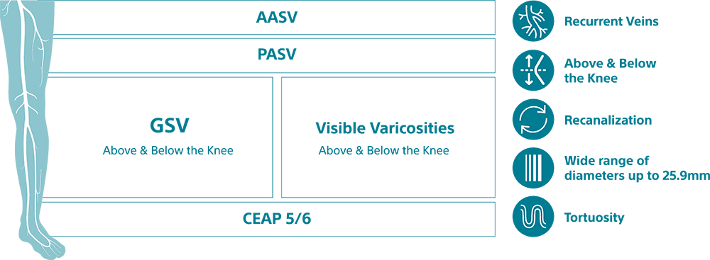 Blue leg with veins left of stacking text, AASV, PASV, GSV, Visible Varicosities, CEAP 5/6